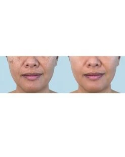 LED Face & Neck Photon Multi-Treatment Mask Women 9 LED Face & Neck Photon Multi-Treatment Mask Women -Care Products 1111480902 RLLD 4