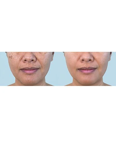 LED Face & Neck Photon Multi-Treatment Mask Women 6 LED Face & Neck Photon Multi-Treatment Mask Women - Image 4