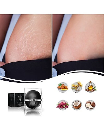 1.69oz Skin Tightening Anti-Stretch Mark Cream Women 4 1.69oz Skin Tightening Anti-Stretch Mark Cream Women - Image 2