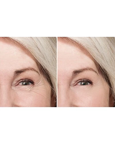 Age Defying Apple & Grape Stem Cell Rapid Eye Lift Women 4 Age Defying Apple & Grape Stem Cell Rapid Eye Lift Women - Image 2